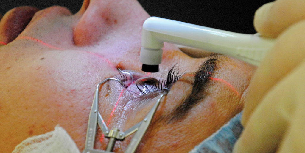 Cataract Eye Surgery In Chandrapur