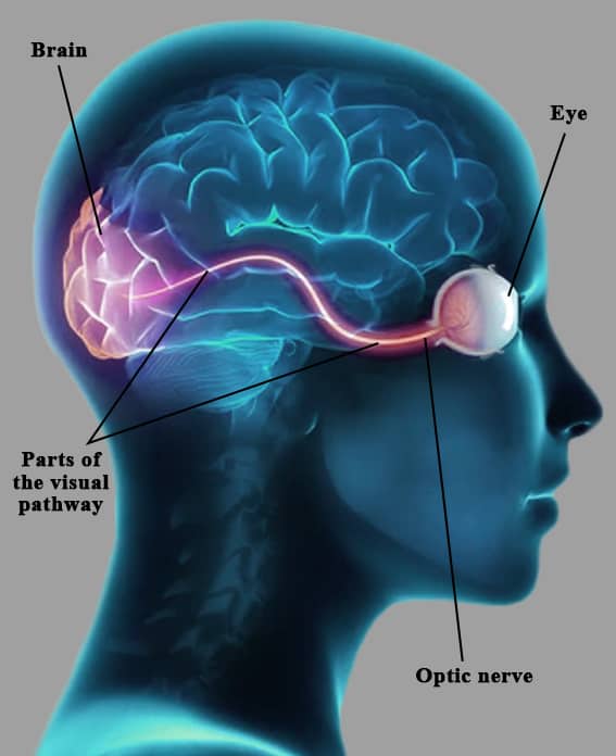 Neuro Ophthalmology In Latur